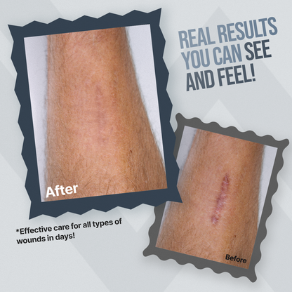 WoundWorx Wound Gel - Trending Wellness Store