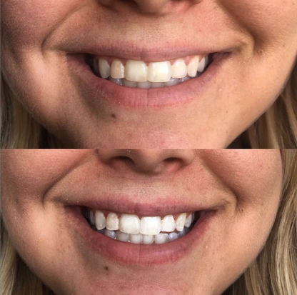 cozy smile kit - Trending Wellness Store