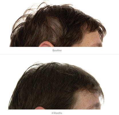 FOLIGAIN® Triple Action Conditioner For Thinning Hair For Women with 2% TRIOXIDIL®